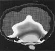 emf_brain2 emf brain2