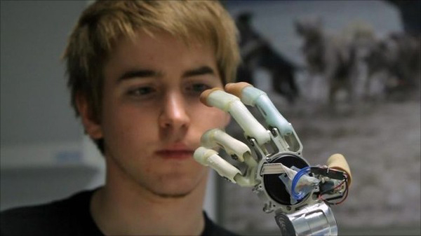 Tangan Bionik Menjadi Solusi Kelumpuhan 5 Bionic Prosthetic