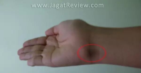 Tips Menghindari Nyeri Pergelangan Tangan saat Beraktivitas Menggunakan Komputer 2 11