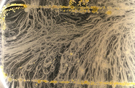 Foto Mikroskop Bakteri yang Bersemayam pada Ponsel 2 bacteria1