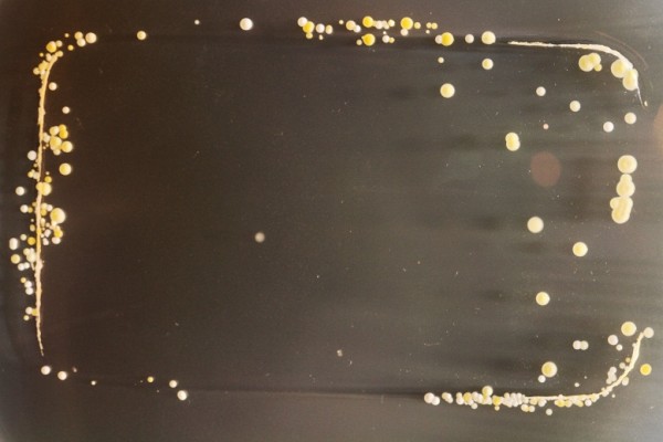 Foto Mikroskop Bakteri yang Bersemayam pada Ponsel 3 bacteria3