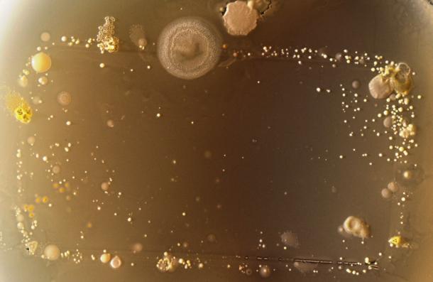 Foto Mikroskop Bakteri yang Bersemayam pada Ponsel 11