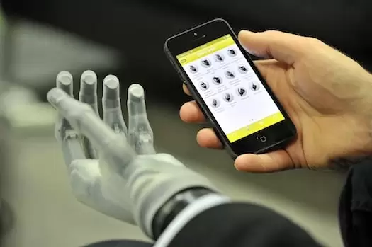Tangan Bionik Ini Dapat Dikendalikan dengan Aplikasi Smartphone 10 ilimb