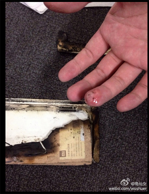 Salah Satu Model Ponsel Xiaomi Mendadak Terbakar 3 Mi2S_01