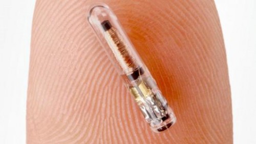 Di Masa Depan, Perangkat Wearable Terpasang di Dalam Tubuh 1 Tubuh