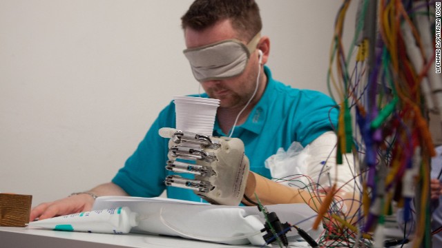 Pria Ini Jadi Orang Pertama Gunakan Tangan Bionik 9 bionic 3