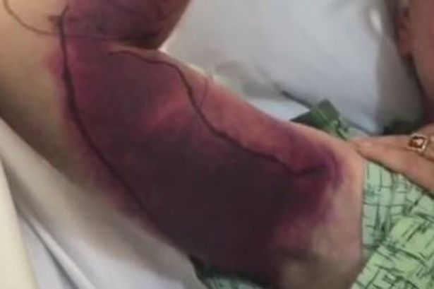 Seorang Pria Selfie Dengan Ular, Apa Yang Terjadi ? 1 Todd-Fassler