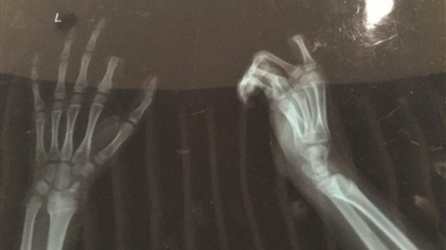 boy finger phone