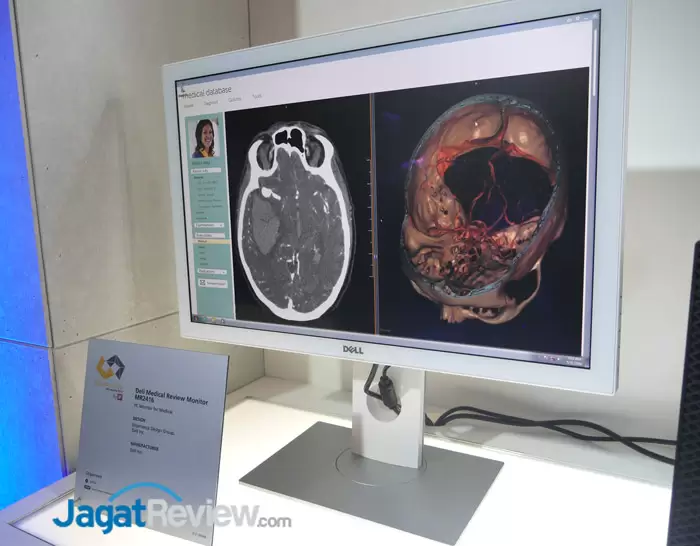 Computex 2016: Produk Dell Raih Penghargaan d&i Awards 34 Dell medical Review Monitor MR2416