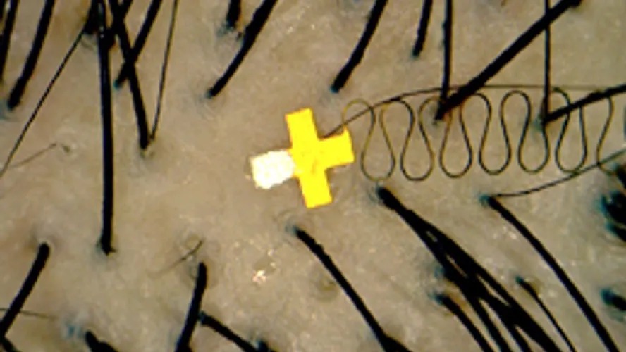 Chip Otak Mini, Lebih Kecil dari Ujung Jarum 2 chip otak